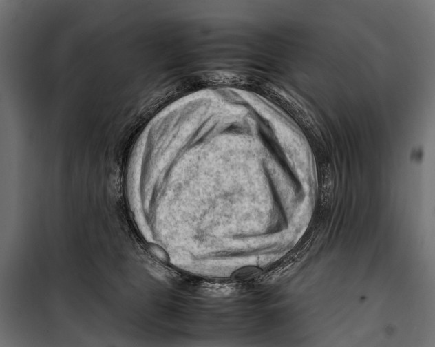 X0000099980469200806201430