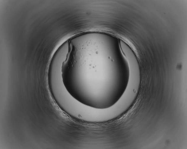 X0000099981138200806201419