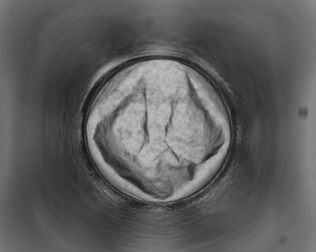 X0000099981222200806201418