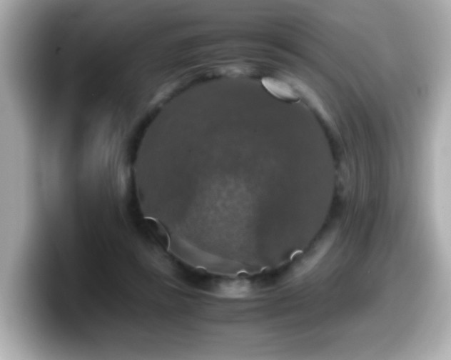 X0000099990355200805231457