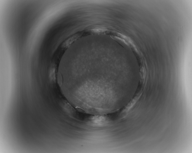 X0000099990762200805231452