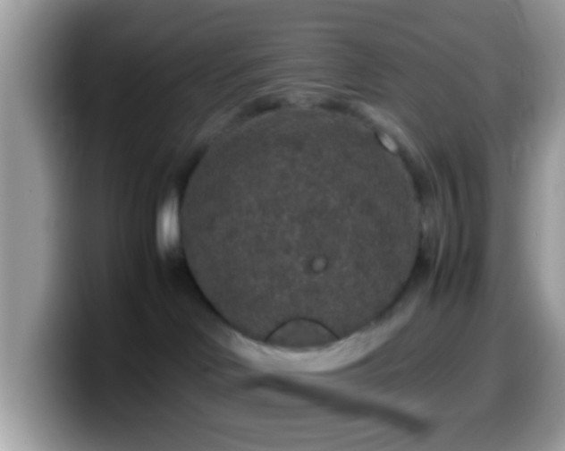 X0000099990046200805301421