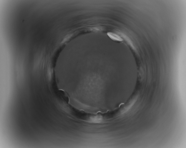 X0000099990355200805301417