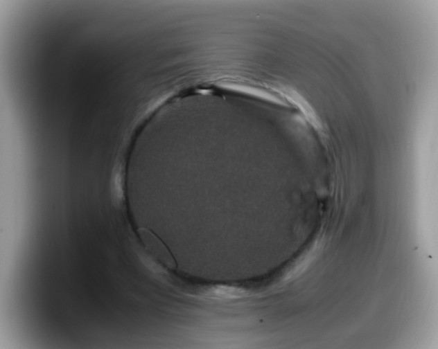 X0000099990393200805301417