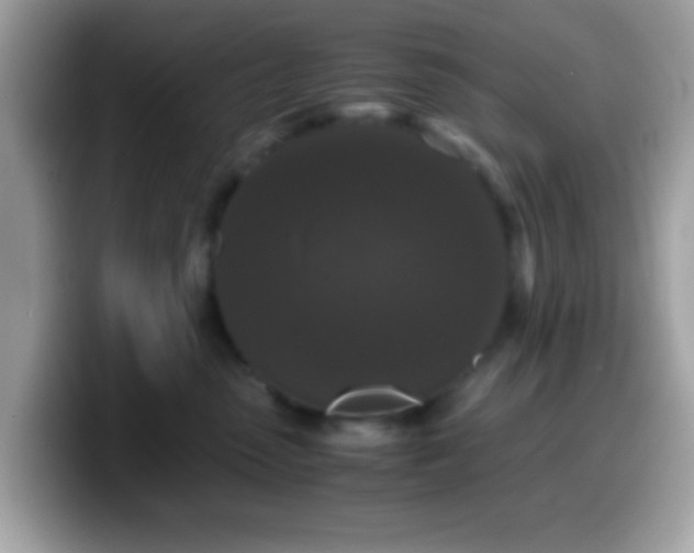 X0000099990475200805301417