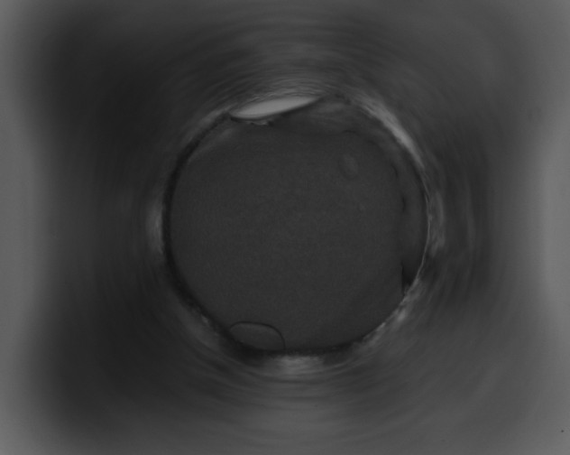 X0000099990154200806061551