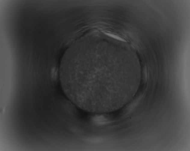 X0000099990177200806061552