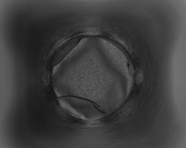 X0000100191448200806201245