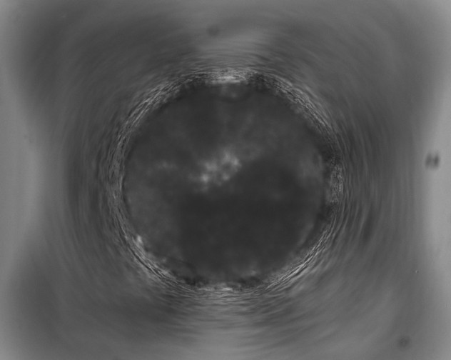 X0000100201441200805301259