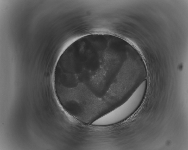 X0000100201440200806061312