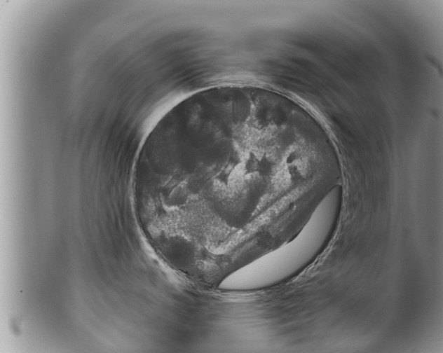 X0000100201440200806201410