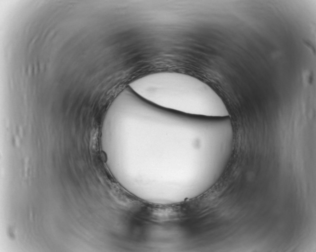 X0000100220177200805300755