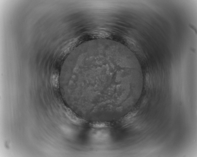 X0000100220177200805301354