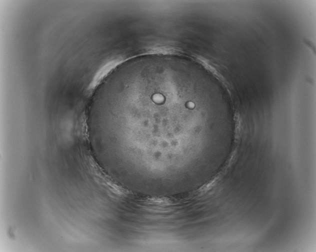 X0000100231215200805301405