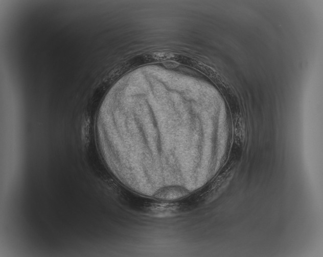 X0000100230319200806201449