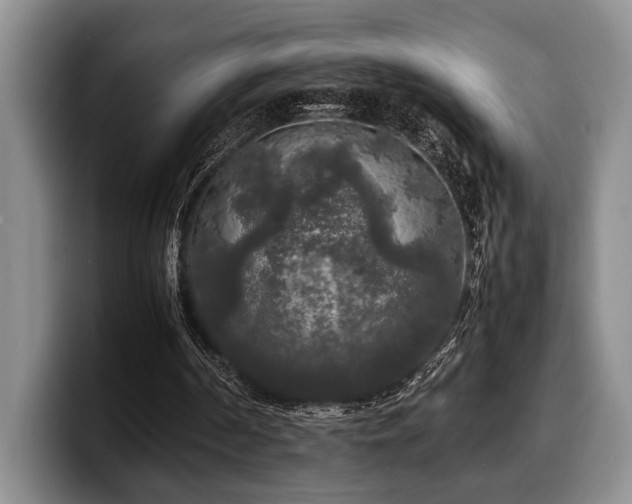 X0000100310194200806051503