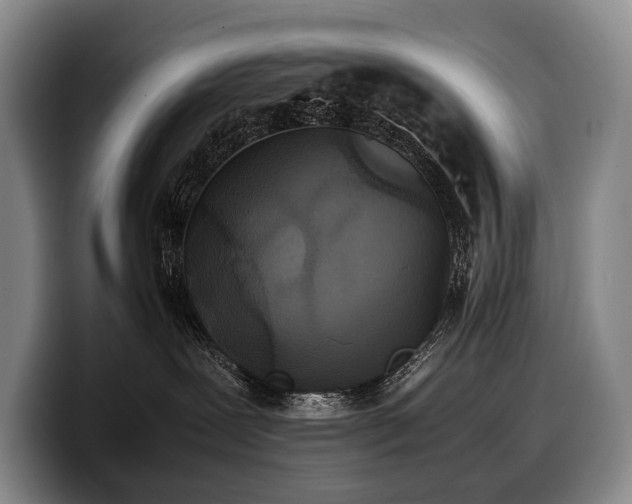 X0000100310239200806051502