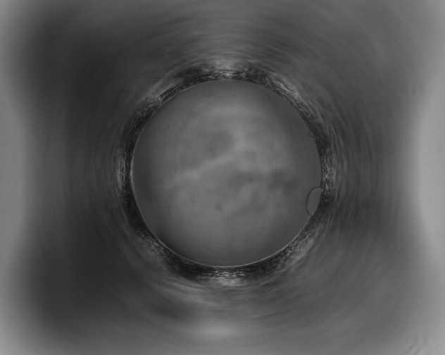 X0000100310656200806051457