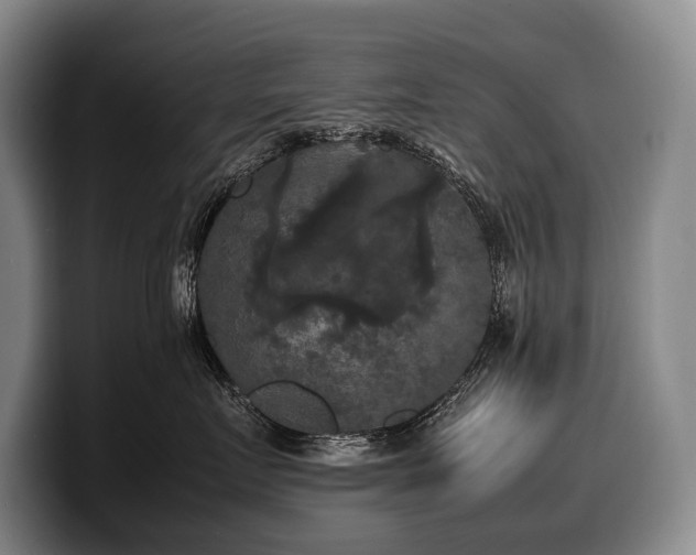 X0000100310719200806051456