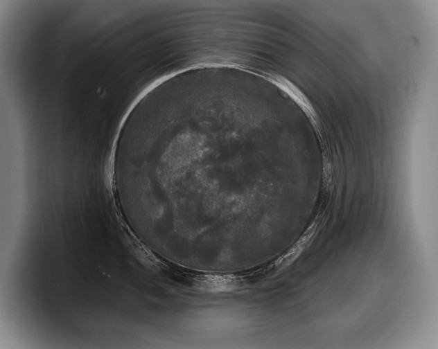 X0000100311052200806051452
