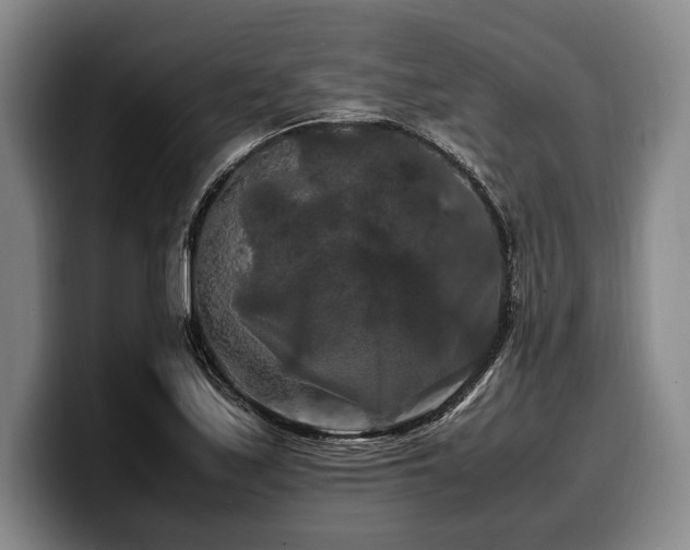 X0000100311171200806051449