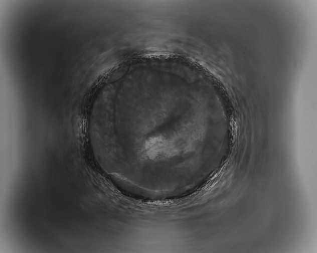 X0000100311351200806051447