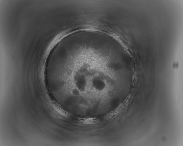 X0000100310151200806121048