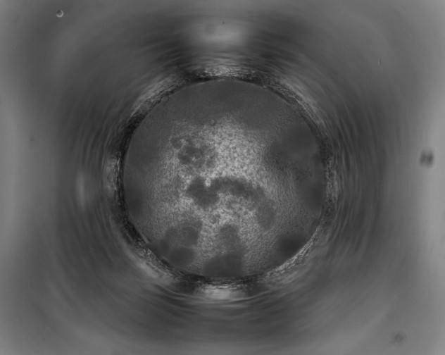 X0000100310171200806121049