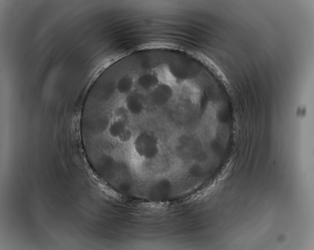 X0000100310937200806121037