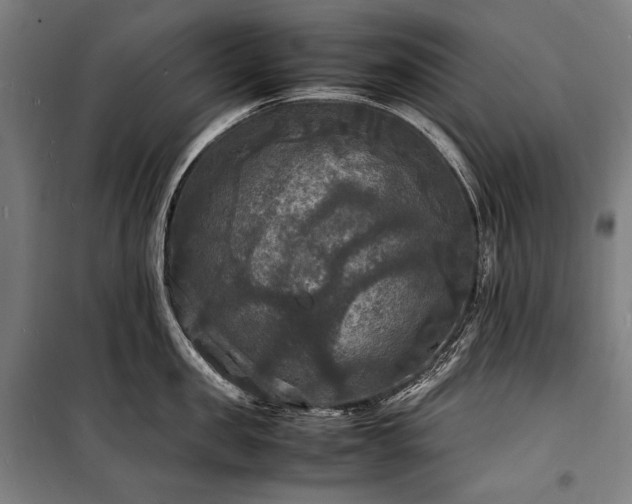 X0000100310957200806121037