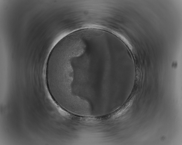 X0000100311007200806121036