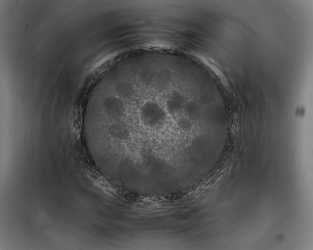 X0000100311015200806121035