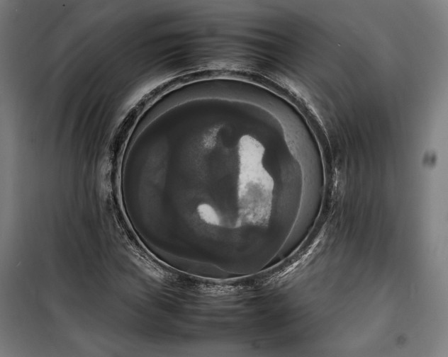 X0000100311019200806121035