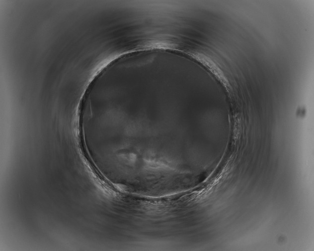 X0000100311031200806121036