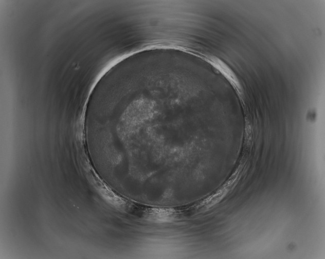 X0000100311052200806121036
