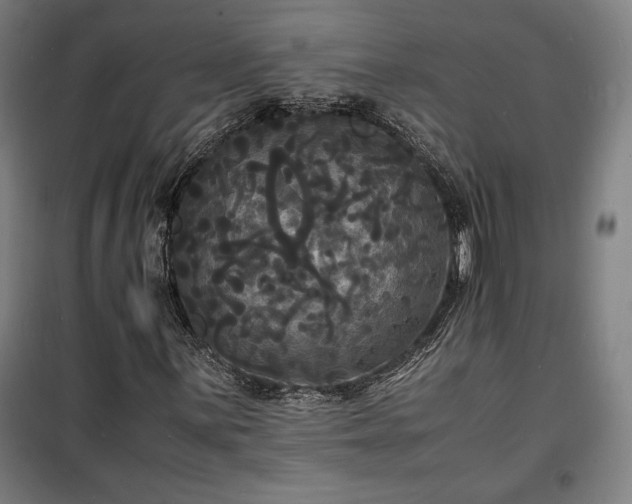 X0000100311059200806121035