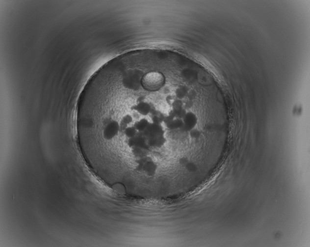 X0000100311079200806121035