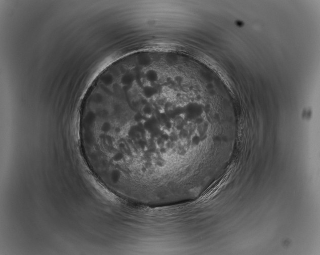 X0000100311083200806121035