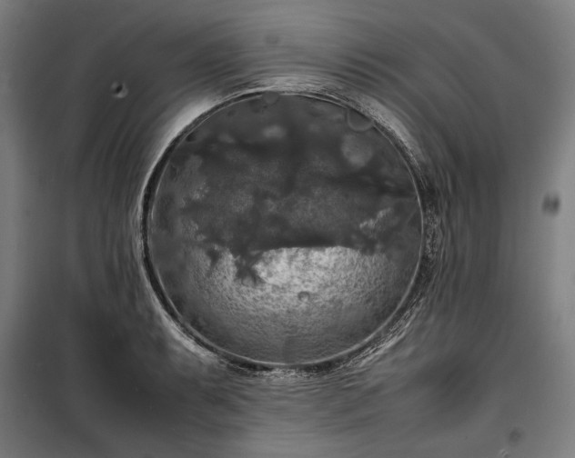X0000100311087200806121035