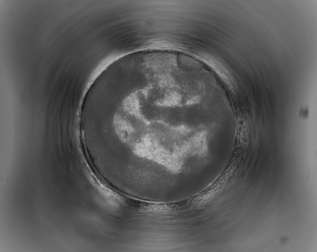 X0000100311094200806121035