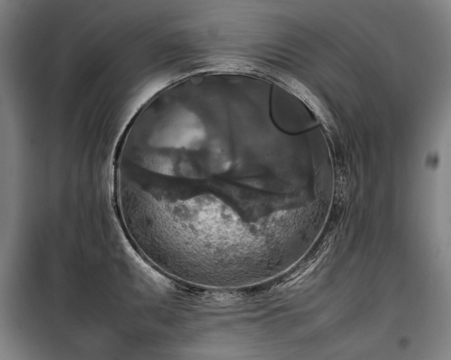 X0000100311095200806121035