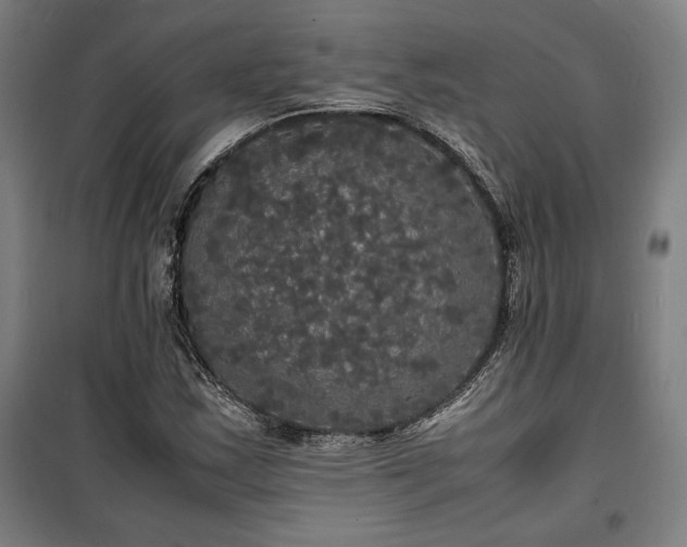 X0000100311163200806121034