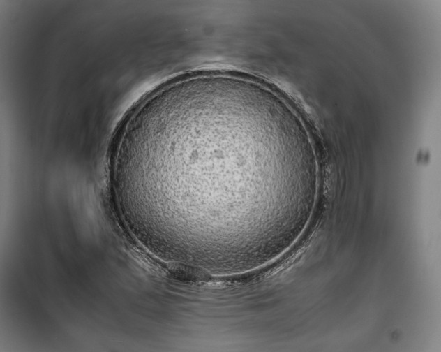 X0000100311167200806121033