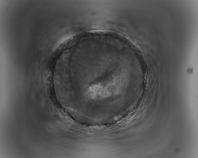 X0000100311351200806121031