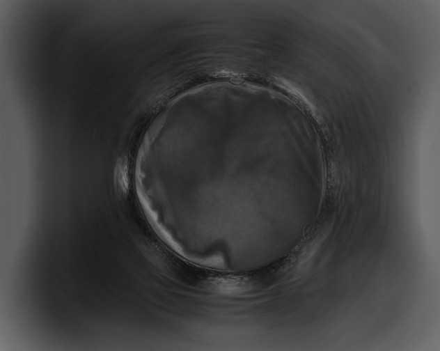 X0000100310069200806190951