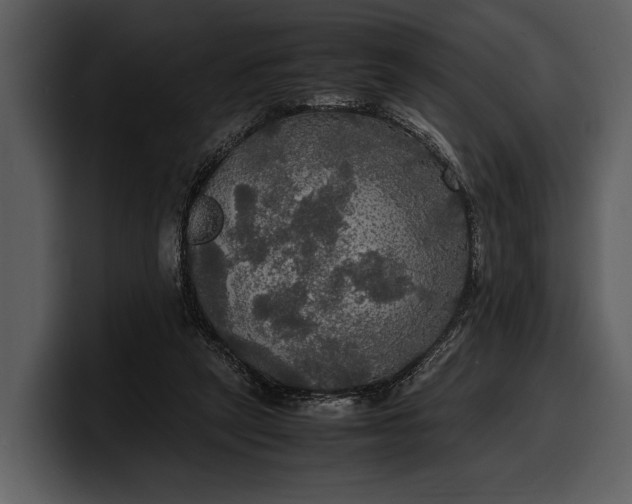 X0000100310257200806190948