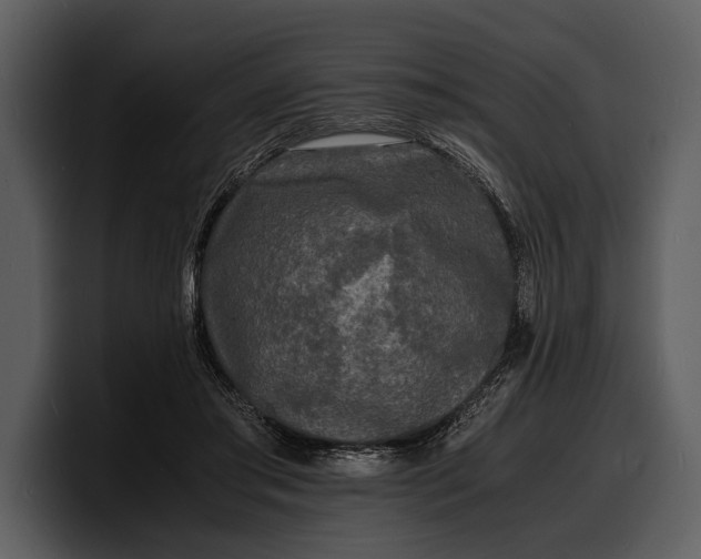 X0000100310405200806190946
