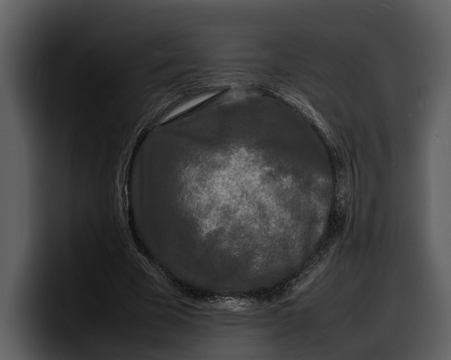 X0000100310585200806190944