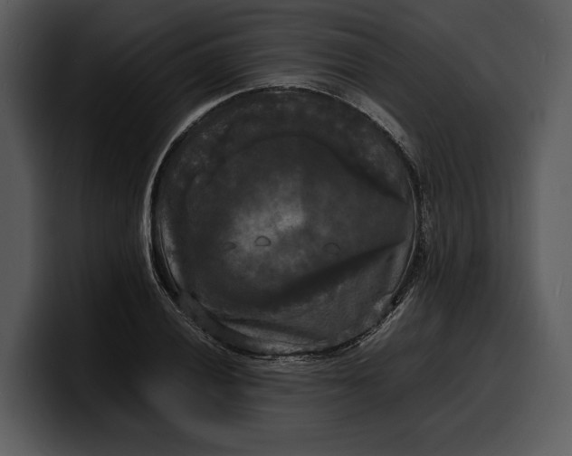 X0000100311028200806190938