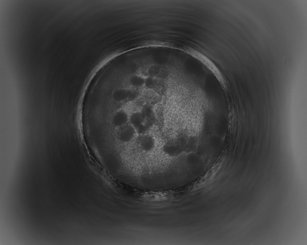 X0000100311051200806190938